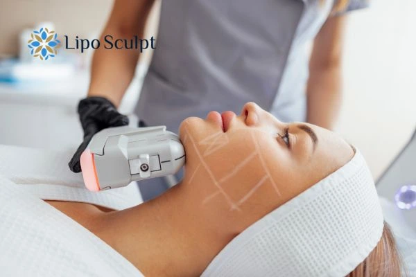 HIFU vs Botulinum Toxin: Understanding the Differences 1 HIFU vs Botox East Mersea What is the best option for you?