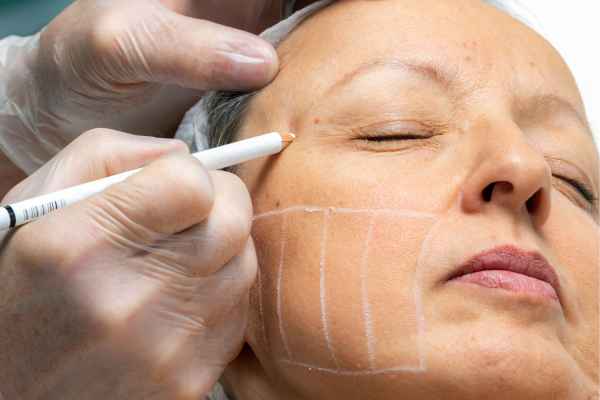 CryoPen: 5 Skin Concerns It May Be Used to Treat 4 What should you ask before having CryoPen treatment East Mersea?
