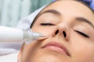 Best Actinic Keratoses Removal 3 Actinic keratoses East Mersea solutions - book in today!