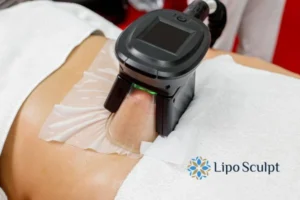 Does Fat Freezing At Home Work? 3 Fat freezing at home from Lipo Sculpt East Mersea
